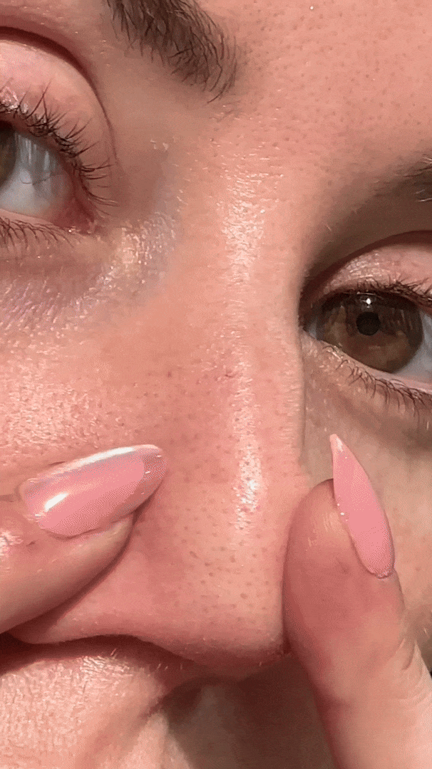 Belorra® Rice Peeling Serum