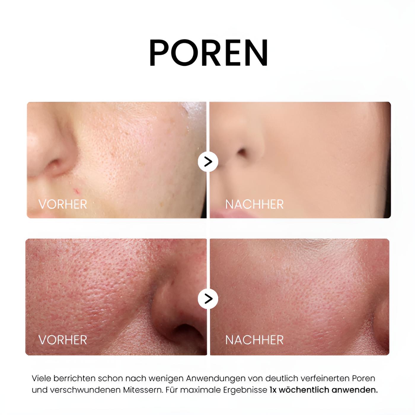 Belorra® Rice Peeling Serum