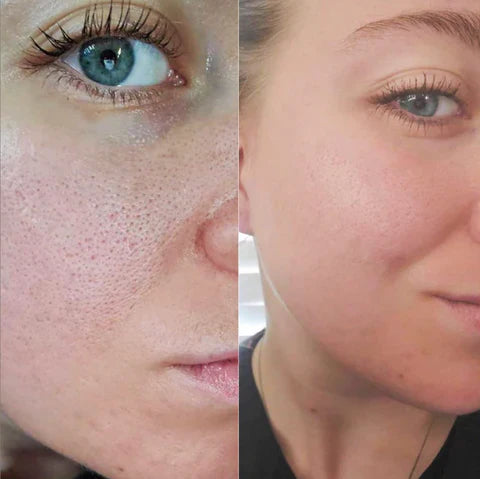 Belorra® Rice Peeling Serum